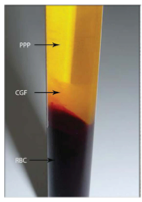 prp plasma